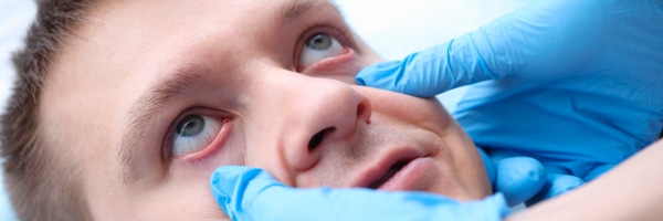 exame ocular